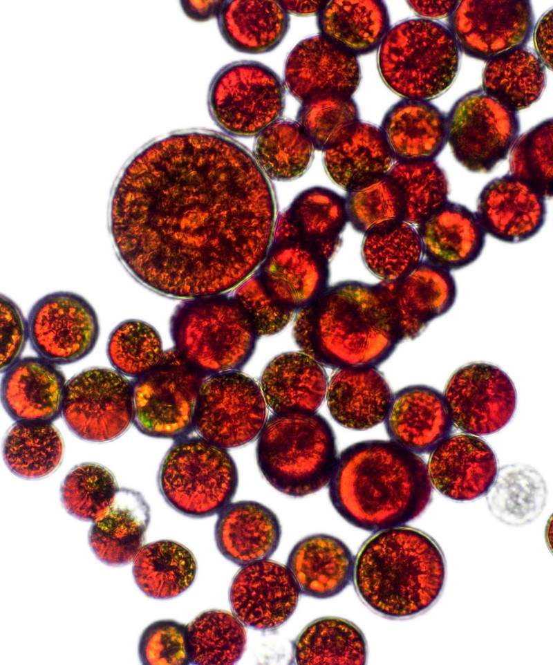 Detailed picture of Astaxanthin Cells